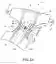 Fig. 05 - ABSORBENT ARTICLE EXHIBITING CONTROLLED DEFORMATION IN USE