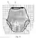 Fig. 22 - Disposable absorbent article silhouettes and silhouette arrays