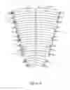 Fig. 07 - Compression garment system with tightening apparatus