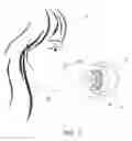 Fig. 02 - Lip enhancement and enlargement device