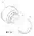 Fig. 07 - Lip enhancement and enlargement device