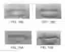 Fig. 22 - Lip enhancement and enlargement device