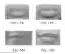 Fig. 23 - Lip enhancement and enlargement device