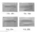 Fig. 24 - Lip enhancement and enlargement device