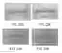 Fig. 26 - Lip enhancement and enlargement device