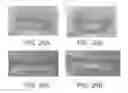 Fig. 27 - Lip enhancement and enlargement device