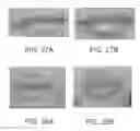 Fig. 28 - Lip enhancement and enlargement device