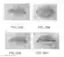 Fig. 29 - Lip enhancement and enlargement device