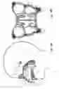 Fig. 05 - Treatment of headache disorders