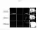 Fig. 11 - Method for inducing pluripotent stem cells and pluripotent stem cells prepared by said method