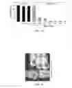 Fig. 09 - COMPOSITIONS AND METHODS FOR TREATING CANCER