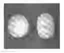 Fig. 01 - Tamper resistant dosage forms