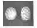 Fig. 01 - Tamper resistant dosage forms