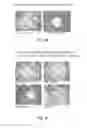 Fig. 28 - Tamper resistant dosage forms