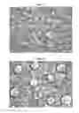Fig. 03 - BUPRENORPHINE TRANSDERMAL DELIVERY SYSTEM