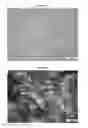 Fig. 05 - BUPRENORPHINE TRANSDERMAL DELIVERY SYSTEM