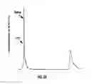 Fig. 08 - COMPOSITIONS AND METHODS FOR TREATING MACULAR DEGENERATION