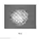 Fig. 09 - Tamper resistant dosage forms