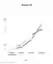 Fig. 02 - Method of Correcting Pathological Human Skin Conditions Related to Aging