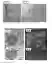 Fig. 02 - METHODS AND COMPOSITIONS TO SUPPORT TRANSPLANTED TISSUE INTEGRATION AND INOSCULATION WITH ADIPOSE STROMAL CELLS