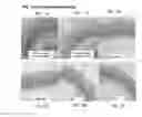 Fig. 02 - Nutritional compositions for promoting gut barrier function and ameliorating visceral pain