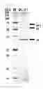 Fig. 04 - Bacteriophage and antibacterial composition comprising the same