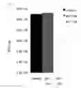 Fig. 09 - Bacteriophage and antibacterial composition comprising the same