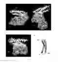 Fig. 07 - Cell-permeable peptide system for treating diseases caused by glutamate excitotoxicity
