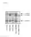 Fig. 07 - Uses of Humanized Cobra Venom Factor for Reducing or Preventing Immunogenicity