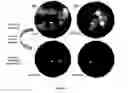 Fig. 05 - Methods of treating CMV retinitis by T cell therapy