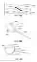 Fig. 37 - Magnetic particle control and visualization