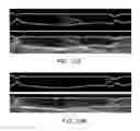 Fig. 46 - Magnetic particle control and visualization