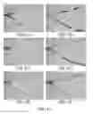 Fig. 50 - Magnetic particle control and visualization