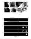 Fig. 11 - TARGETED POLYMERIC NANO-COMPLEXES AS DRUG DELIVERY SYSTEM