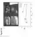Fig. 15 - Peptide-Based Compounds and Their Uses for Tumor Imaging and Targeting