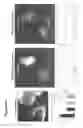 Fig. 19 - Peptide-Based Compounds and Their Uses for Tumor Imaging and Targeting