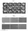 Fig. 03 - In situ tissue engineering