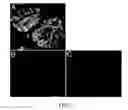 Fig. 04 - Method for Decellularization of Tissue Grafts