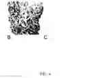 Fig. 05 - Method for Decellularization of Tissue Grafts