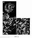 Fig. 07 - Method for Decellularization of Tissue Grafts