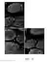 Fig. 13 - Method for Decellularization of Tissue Grafts