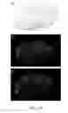 Fig. 16 - Method for Decellularization of Tissue Grafts