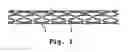 Fig. 02 - Drug delivery endovascular stent and method of use