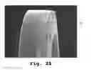 Fig. 03 - Drug delivery endovascular stent and method of use