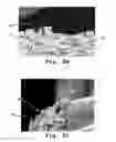 Fig. 04 - Drug delivery endovascular stent and method of use