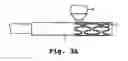 Fig. 05 - Drug delivery endovascular stent and method of use