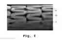 Fig. 08 - Drug delivery endovascular stent and method of use