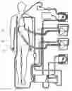 Fig. 01 - Device for aspirating and transferring blood