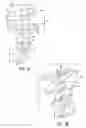 Fig. 04 - Method of removing excess fluid from a patient with hemodilution