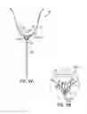 Fig. 11 - Method of removing excess fluid from a patient with hemodilution